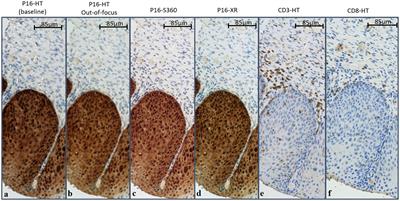 CNN stability training improves robustness to scanner and IHC-based image variability for epithelium segmentation in cervical histology